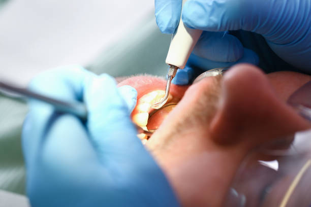Best Mobile Emergency Dentist in Desert View Highlands, CA